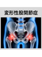 熊本カワル整体 JR上熊本駅院/股関節部の痛み