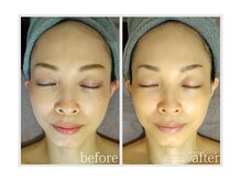 アン グレーヌ 自由が丘(unegraine)/キュキュッと引き締まる輪郭