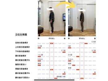 しのまる整体/<グループ院事例>猫背姿勢の改善