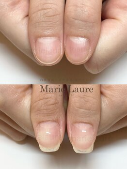 マリーロール 梅田店(Marie Laure)/深爪矯正/自爪育成/自爪風
