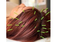 チョコバリ 郡山店(chocobari)/育毛×頭皮ケア【育毛鍼】40代