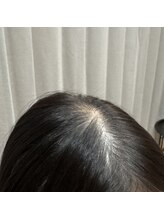 マイントゥー(mine too)/髪の細さにお悩みの方にも！！