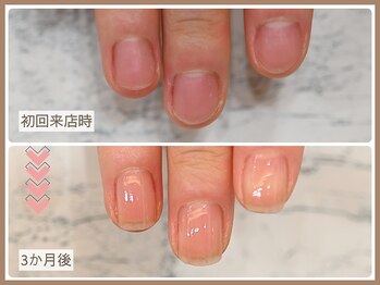 ルシェルアイ/【自爪育成コース】
