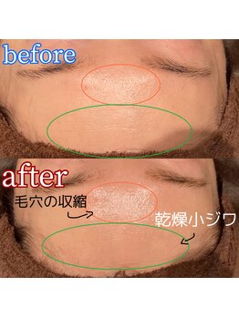 ヨシザワインク バンダイ(YOSHIZAWA Inc. BANDAI)/O2シェービングコース