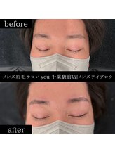 ユー 千葉駅前店(you)/ビフォ－アフター写真