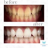 ホワイトニングショップ 広島店(WHITENING SHOP)