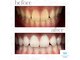 ホワイトニングショップ 広島店(WHITENING SHOP)の写真