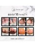 巻き爪ケア10本（ジェルのオフがない方）