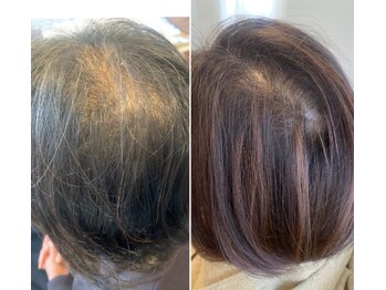 セリジェ 青山の写真/【プロセルセラピーズ】痛みが少ない＆これまでにないほどスピード実感できる本気の頭皮環境改善/育毛促進!