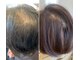 セリジェ 青山の写真/【プロセルセラピーズ】痛みが少ない＆これまでにないほどスピード実感できる本気の頭皮環境改善/育毛促進!