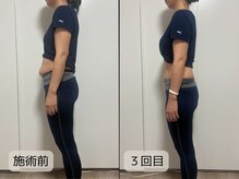 優子さんの美容矯正サロン/お腹周りがスッキリすると痩身◎