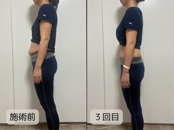 優子さんの美容矯正サロン/お腹周りがスッキリすると痩身◎