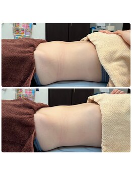 ビューティスタジオ韓美 いわき店/施術後にしっかり効果実感◎