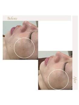 ファロンビューティー(fallon beauty)/お客様ビフォー×アフター