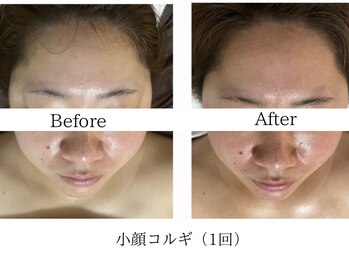 サロン ル プレジール(Salon le Plaisir)/小顔&むくみ改善/男性OK