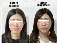 サロンスマイル