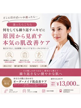 ミベル フェイシャルサロン(MIBELL FACIAL SALON)の写真/【迷ったらこちら★繰り返すニキビに】原因から見直す本気の肌改善ケア 32,600→13,000