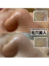 フェイシャルサロン アリイ(ALII)/毛穴美人