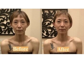 アジール 長岡リバーサイド千秋店(agir)/before/after画像