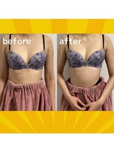 コモド(COMODO)/お腹・背中のお肉がバストに