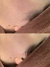 【ワックス顔脱毛】まずはお試し◇パーツ2か所＋保湿パック6600円→