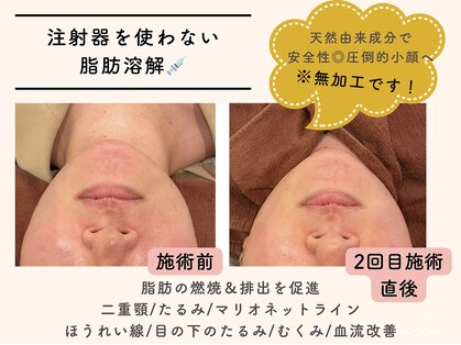 ミーカラー(mecalla.)の写真