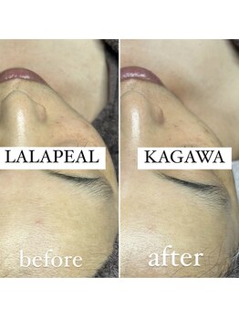 プチ(Petit.)/韓国発☆ララピール