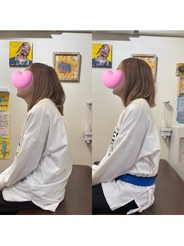 ヒデ整体院(Hide整体院)/猫背矯正骨盤矯正B/A肩こり腰痛