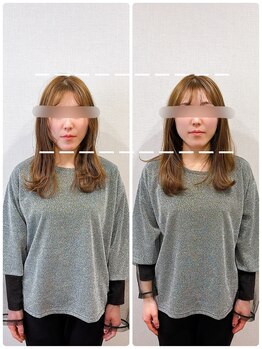 イズム まつもと店(izm)/小顔モニター様