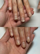 マイントゥ ネイル(mine too nail)/ホームケアとサロンケアで別人！