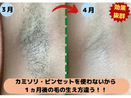 ディスイズミー シュガーリング(This is me Sugaring)の写真