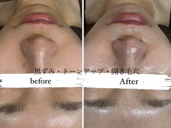 ビノスビューティー(vinos.beauty)の写真/〈南小倉駅すぐNEWOPEN〉もう隠さない!毛穴・シミ・たるみ改善へ導く大人の肌革命サロン!限定クーポンあり!