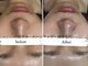 ビノスビューティー(vinos.beauty)の写真/〈南小倉駅すぐNEWOPEN〉もう隠さない!毛穴・シミ・たるみ改善へ導く大人の肌革命サロン!限定クーポンあり!