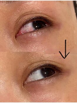 スーコ(SU:CO)/源流中医学志筋術【目】