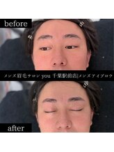 ユー 千葉駅前店(you)/ビフォ－アフター写真