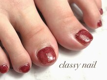 クラッシーネイル(classy nail)の雰囲気（当店では巻き爪ケアジェルがとても大人気です☆）