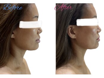 グレイスシャイン(GraceShine)/【レモンボトル】