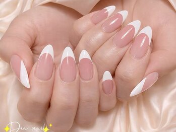 フレンチ/カラグラ/フィルイン