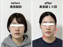 サロンスマイル