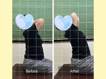 ナオル整体 春日部院(NAORU整体)/背中の痛みが改善