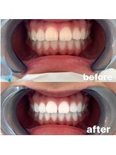 ライトビューティー 池袋店(LightBeauty)/症例写真