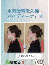 ヨサパーク ナナラーレア 福島店(YOSA PARK nanala lea)/痩身/ダイエット/リンパ/産後