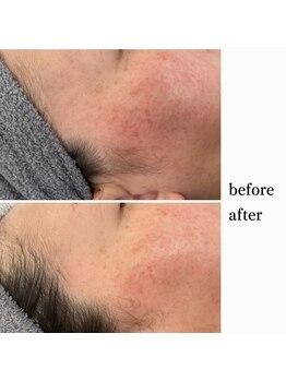 アンドスロウ(&slow)/赤み乾燥敏感肌にはマーメイド