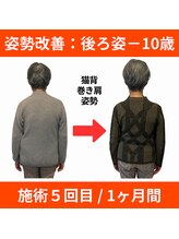 ララ鍼灸サロン(LaLa鍼灸サロン)/丸い背中は年のせいじゃない