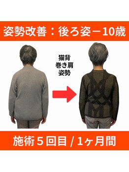 ララ鍼灸サロン(LaLa鍼灸サロン)/丸い背中は年のせいじゃない