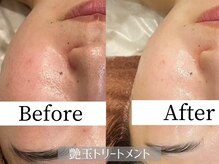 フローレンス(Florence)の雰囲気（艶玉トリートメントで毛穴レス肌どんなお肌も綺麗になれる♪）