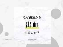 ホワイト つくば店(WHITE)/サロン豆知識