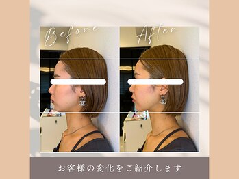 整え屋 レッド(RED)/小顔矯正 20代女性
