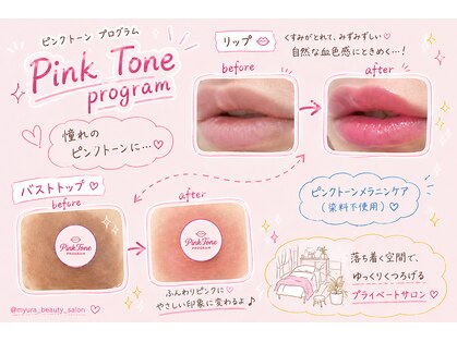 ミュラ(myura)の写真