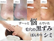 ティーツリー 名古屋 桜山(Tea Tree)